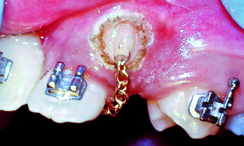 CC_in_place_CRaw-1024x614