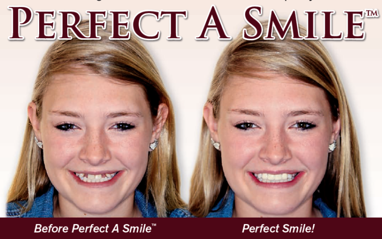 PerfectASmile-768x481