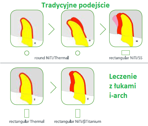 i-arch_podejście-leczenia