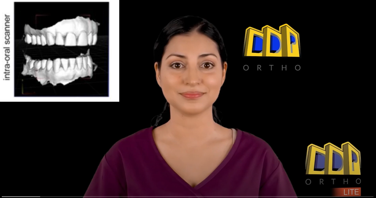 Jaka jest różnica między skanami a cyfrowymi modelami diagnostycznymi DDP-Ortho