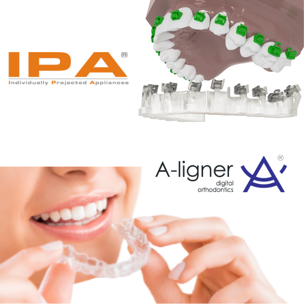 IPA a ligner