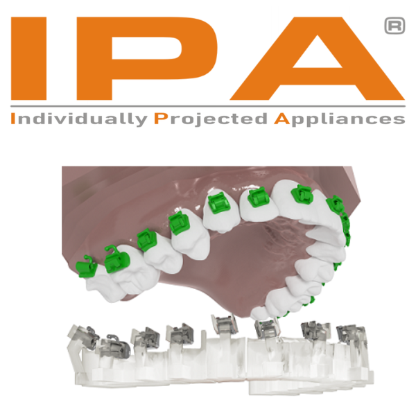 IPA