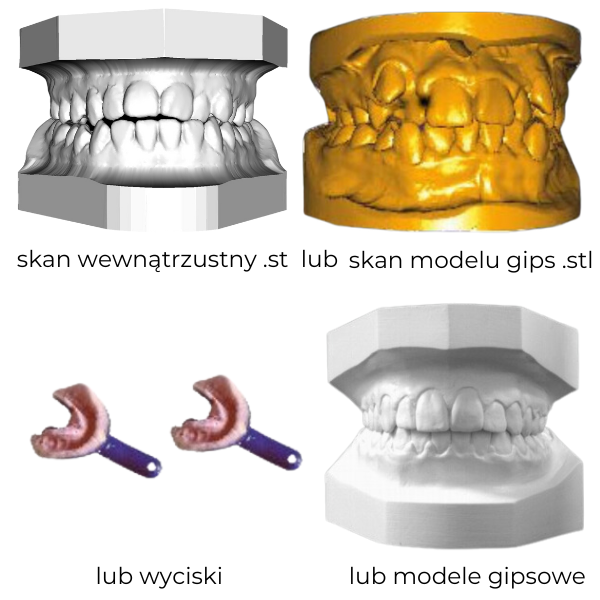 skan wewnątrzustny lub wysiski