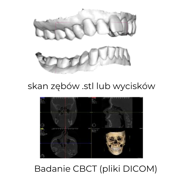 skan zębów stl