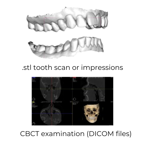 stl scan