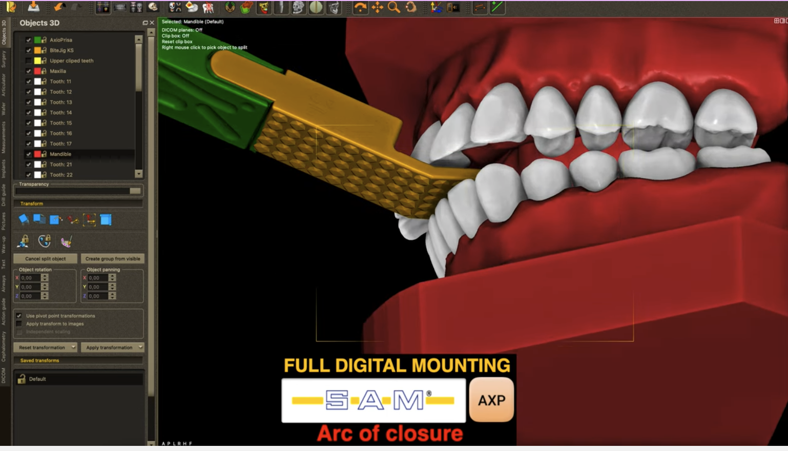 Możliwości w DDP-Ortho - dr Kamil Stefański